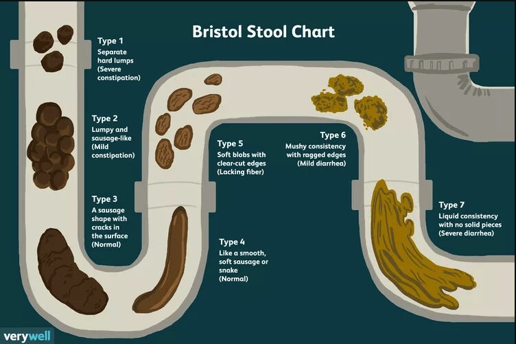 Bristol stool chart types 1-7